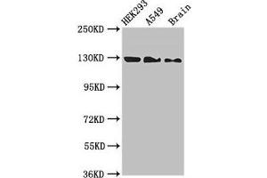 Western Blot Positive WB detected in: HEK293 whole cell lysate, A549 whole cell lysate, Mouse brain tissue All lanes: EIF4ENIF1 antibody at 2.