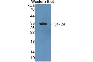 Detection of Recombinant C4, Mouse using Polyclonal Antibody to Complement Component 4 (C4) (Complement C4 antibody  (AA 126-366))
