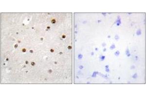 Immunohistochemistry analysis of paraffin-embedded human brain tissue, using TSN Antibody.