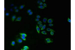 Immunofluorescent analysis of PC-3 cells using ABIN7173067 at dilution of 1:100 and Alexa Fluor 488-congugated AffiniPure Goat Anti-Rabbit IgG(H+L) (TMEM14A antibody  (AA 45-78))