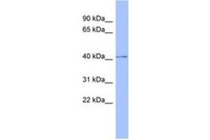 Image no. 1 for anti-Protein Kinase, CAMP-Dependent, Regulatory, Type I, beta (PRKAR1B) (C-Term) antibody (ABIN6744076)