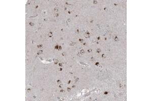 Immunohistochemical staining of human lateral ventricle with AGPS polyclonal antibody  shows strong cytoplasmic positivity in neuronal cells at 1:200-1:500 dilution. (AGPS antibody)