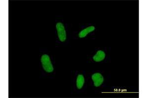 Immunofluorescence of purified MaxPab antibody to ZNF358 on HeLa cell. (ZNF358 antibody  (AA 1-481))