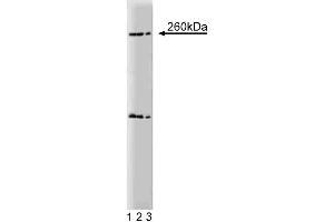 Western blot analysis of Nestin on a rat (E17) cerebrum lysate. (Nestin antibody  (AA 402-604))