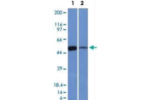 Western Blot analysis of Lane 1: K562 and Lane 2: lung lysates with ALDH1A1 monoclonal antibody, clone ALDH1A1/1381 .