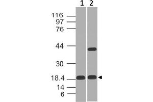 Image no. 1 for anti-Elastase 3B, Pancreatic (ELA3B) (AA 18-227) antibody (ABIN5027106) (Elastase 3B antibody  (AA 18-227))