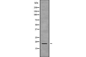Western blot analysis of ZNHIT1 using COLO205 whole cell lysates (ZNHIT1 antibody  (Internal Region))