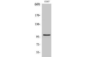 Western Blotting (WB) image for anti-AP2 associated kinase 1 (AAK1) (Internal Region) antibody (ABIN3173608) (AAK1 antibody  (Internal Region))