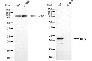 anti-Basic Transcription Factor 3 (BTF3) antibody