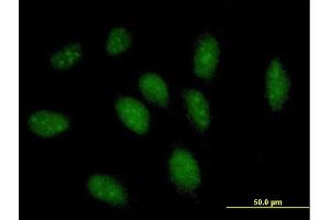 Immunofluorescence of purified MaxPab antibody to GCH1 on HeLa cell. (GCH1 antibody  (AA 1-250))