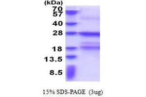 SDS-PAGE (SDS) image for Fc Fragment of IgE Receptor Ia (FCER1A) (AA 26-205) protein (His tag) (ABIN5853327)
