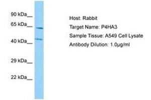 Image no. 1 for anti-Prolyl 4-Hydroxylase, alpha Polypeptide III (P4HA3) (AA 77-126) antibody (ABIN6750125) (P4HA3 antibody  (AA 77-126))