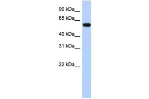 WB Suggested Anti-ZNF554 Antibody Titration:  0.