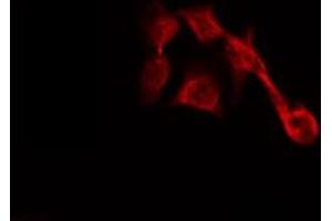 ABIN6267024 staining HepG2 by IF/ICC. (SDC4 antibody  (C-Term))