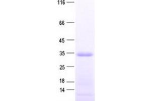 Validation with Western Blot (ART1 Protein (His tag))