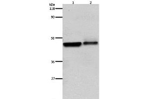 Western Blot analysis of Hela and A549 cell using ADRB2 Polyclonal Antibody at dilution of 1:600 (beta 2 Adrenergic Receptor antibody)
