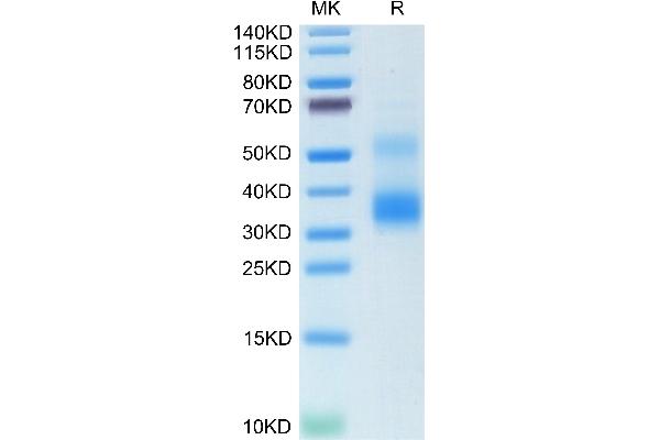 RANKL Protein (AA 63-244)