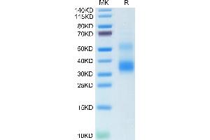 Human Rankl on Tris-Bis PAGE under reduced condition. (RANKL Protein (AA 63-244))