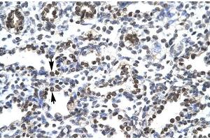 Human Lung (CIC antibody  (N-Term))