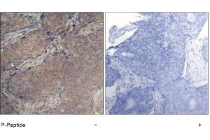 Image no. 1 for anti-Myosin, Light Chain 2, Regulatory, Cardiac, Slow (MYL2) (pSer18) antibody (ABIN319223)