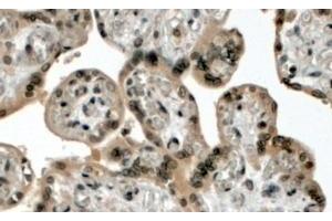(4µg/ml) staining of paraffin embedded Human Placenta. (Lysine (K)-Specific Methyltransferase 2B (KMT2B) (N-Term) antibody)