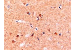ABIN2563481 (2µg/ml) staining of paraffin embedded Human Brain. (CD11b antibody  (Internal Region))