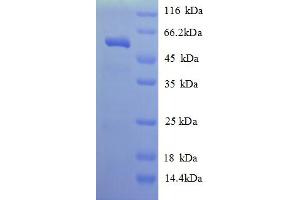 SDS-PAGE (SDS) image for Kallikrein 7 (KLK7) (AA 28-253) protein (His tag) (ABIN5709811) (Kallikrein 7 Protein (KLK7) (AA 28-253) (His tag))