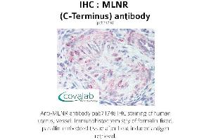 Image no. 1 for anti-Motilin Receptor (MLNR) (C-Term), (Cytoplasmic Domain) antibody (ABIN1736988) (Motilin Receptor antibody  (C-Term, Cytoplasmic Domain))