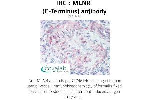Image no. 1 for anti-Motilin Receptor (MLNR) (C-Term), (Cytoplasmic Domain) antibody (ABIN1736988)