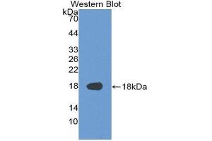 Western Blotting (WB) image for anti-Supervillin (SVIL) (AA 1385-1525) antibody (ABIN3201726) (Supervillin antibody  (AA 1385-1525))