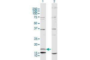 Western Blot analysis of NRG4 expression in transfected 293T cell line by NRG4 MaxPab polyclonal antibody. (Neuregulin 4 antibody  (AA 1-115))