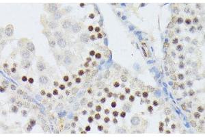 Immunohistochemistry of paraffin-embedded Mouse testis using ANKRD52 Polyclonal Antibody at dilution of 1:100 (40x lens). (ANKRD52 antibody)