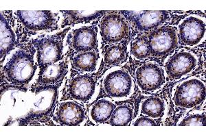 Detection of PON1 in Human Colon Tissue using Polyclonal Antibody to Paraoxonase 1 (PON1) (PON1 antibody  (AA 35-206))