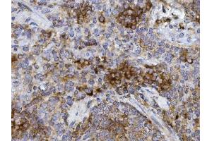 anti-Growth Factor Receptor-Bound Protein 10 (GRB10) (AA 1-276) antibody