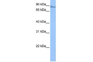 WB Suggested Anti-ZNF432 Antibody Titration:  0. (ZNF432 antibody  (N-Term))