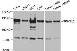 Western blot analysis of extracts of various cell lines, using SKIV2L2 antibody. (MTR4 antibody)