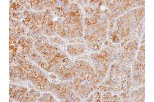 Immunohistochemistry (IHC) image for anti-alpha Tubulin (TUBA1) antibody (ABIN2856635)