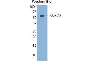 Western blot analysis of the recombinant protein. (ALDH7A1 antibody  (AA 1-539))