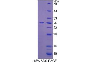 Image no. 1 for Interleukin 12 alpha (IL12A) (AA 23-215) protein (His tag) (ABIN4988285) (IL12A Protein (AA 23-215) (His tag))