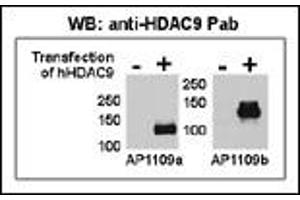 Both anti-HDAC9 N-term ((ABIN387960 and ABIN2844679)) and C-term ((ABIN387961 and ABIN2844680)) Pab were tested by WB and IP-WB using HeLa and HeLa-HDAC9 transfected cells. (HDAC9 antibody  (N-Term))