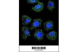 Confocal immunofluorescent analysis of ID1 antibody with U-251MG cells followed by Alexa Fluor 488-conjugated goat anti-rabbit lgG (green). (ID1 antibody  (AA 66-93))