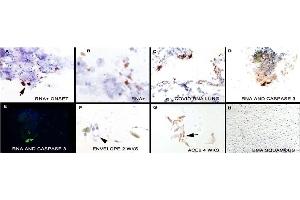 IHC Validation in COVID-19 Patient Sample: (Nuovo et al. (SARS-CoV-2 Envelope antibody  (N-Term))