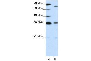 WB Suggested Anti-PRDM13  Antibody Titration: 1. (PRDM13 antibody  (C-Term))
