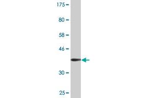 Western Blot detection against Immunogen (36. (PHOSPHO1 antibody  (AA 168-266))