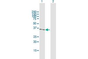 Western Blot analysis of PRMT6 expression in transfected 293T cell line by PRMT6 MaxPab polyclonal antibody. (PRMT6 antibody  (AA 1-316))