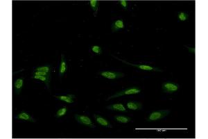 Immunofluorescence of monoclonal antibody to EIF4EBP3 on HeLa cell. (EIF4EBP3 antibody  (AA 1-100))