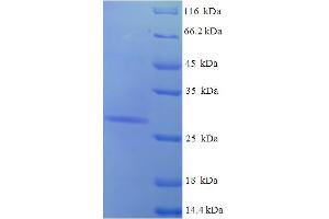 SDS-PAGE (SDS) image for Aquaporin 1 (Colton Blood Group) (AQP1) (AA 220-269), (partial) protein (His-SUMO Tag) (ABIN5709071) (Aquaporin 1 Protein (AA 220-269, partial) (His-SUMO Tag))