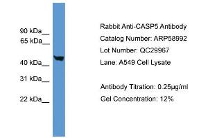 WB Suggested Anti-CASP5  Antibody Titration: 0. (CASP5 antibody  (Middle Region))