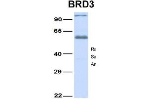 Western Blotting (WB) image for anti-Bromodomain Containing 3 (BRD3) (Middle Region) antibody (ABIN2775791)
