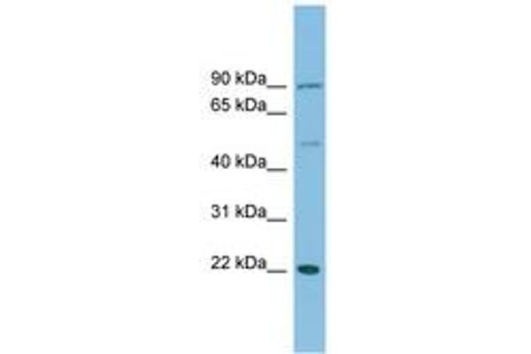 DNAJC12 antibody  (C-Term)